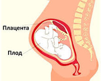 Гиперплазия плаценты