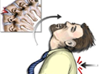 Позвоночно-спинномозговая травма