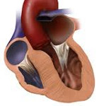 Гипертрофическая кардиомиопатия: Гипертрофическая кардиомиопатия