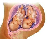 Многоплодная беременность: Многоплодная беременность
