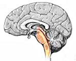 Опухоли ствола мозга: Опухоли ствола мозга