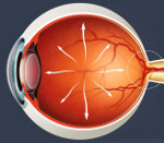Открытоугольная глаукома: Открытоугольная глаукома