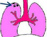 Очаговый туберкулез легких: Очаговый туберкулез легких