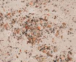 Песок в почках: Песок в почках