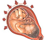 Повышенный тонус матки при беременности (Гипертонус матки)