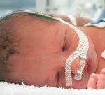 Родовая травма новорожденных: Родовая травма новорожденных