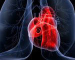 Саркоидоз сердца : Саркоидоз сердца (Кардиальный саркоидоз, Саркоидозная кардиомиопатия)